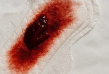 لخته خون در پریودی