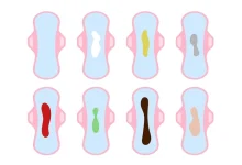 رنگ ترشحات واژن