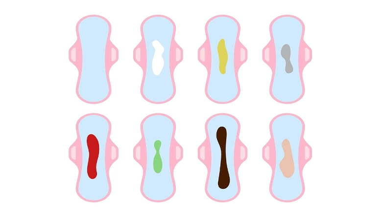 رنگ ترشحات واژن