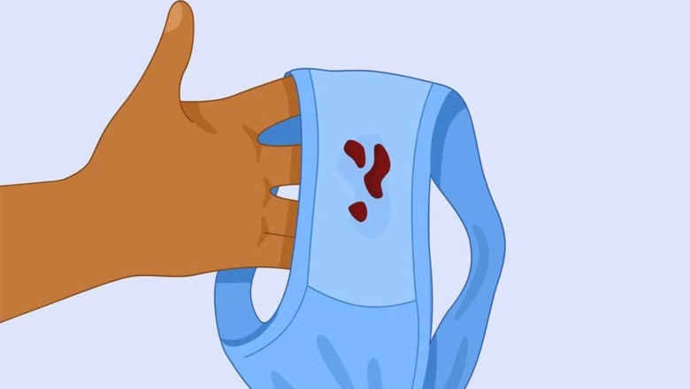 برای درمان ترشحات غیرطبیعی واژن