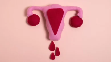 علت خونریزی شدید در پریودی