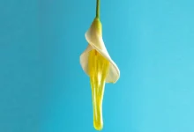 ترشحات زرد رنگ واژن