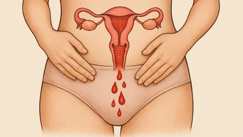 داروهای هورمونی برای جلوگیری از بارداری یکی از شایع علتهای خونریزی بعد از پریود هستند