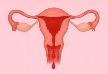 علت خونریزی رحم بعد از پریود