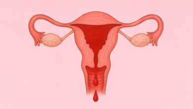 علت خونریزی رحم بعد از پریود