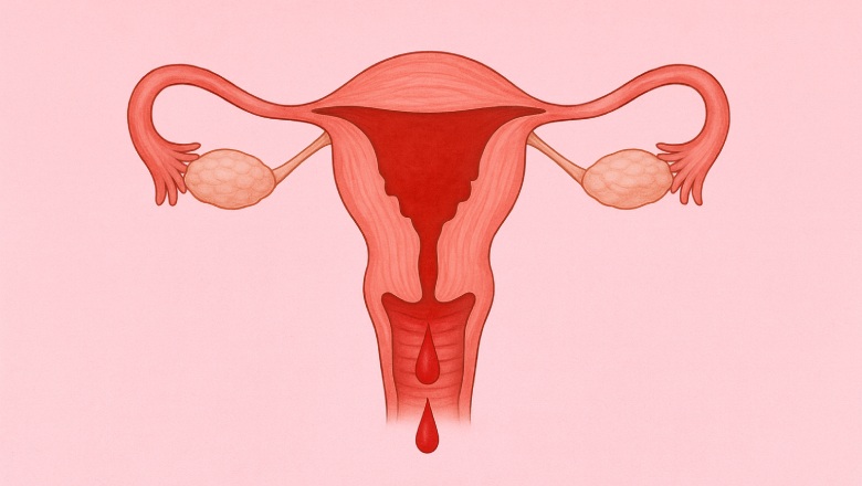 علت خونریزی رحم بعد از پریود