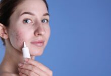 درمان جوش های هورمونی