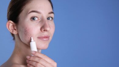 درمان جوش های هورمونی